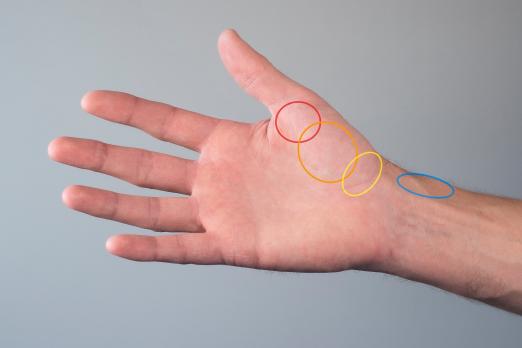 Diagnostiek en therapie bij pijn in de duimregio (VI)