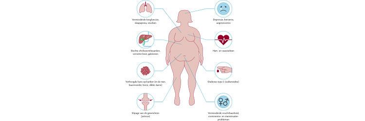 Obesitas: gendiagnostiek of geen diagnostiek?