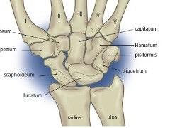 Externe fixateur bij distale radiusfracturen
