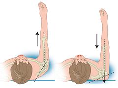 Corrigeren van verminderde scapulacontrole bij schouderklachten