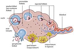 Menstruatiestoornissen