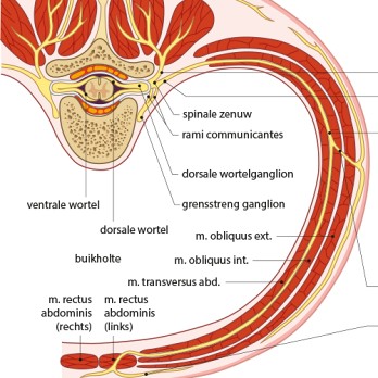 Anterior curaneous nerve entrapment syndrome (ACNES) als oorzaak van chronische buikpijn bij kinderen 