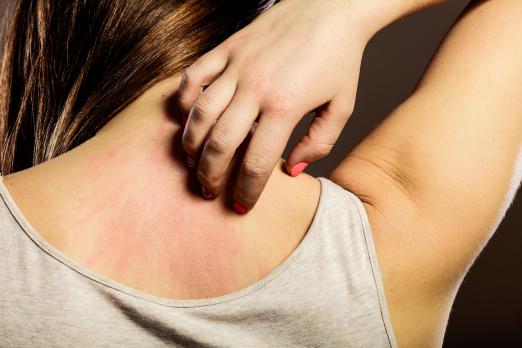 Inleiding allergie