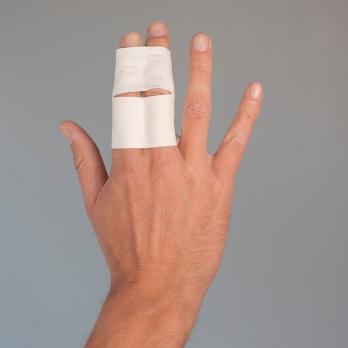 Fysiotherapeutische beoordeling van gesloten vingertraumata (VI)