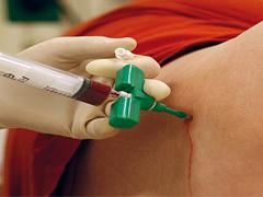 Acute myeloïde leukemie