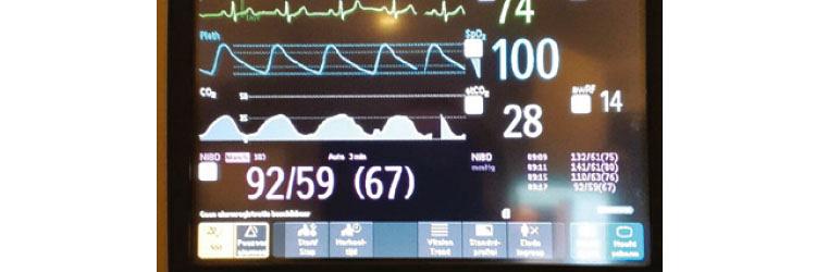 Procedurele sedatie en analgesie 