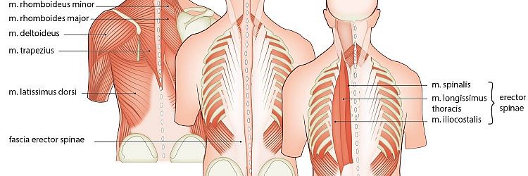 ESPB: het erector spinae plane-block 