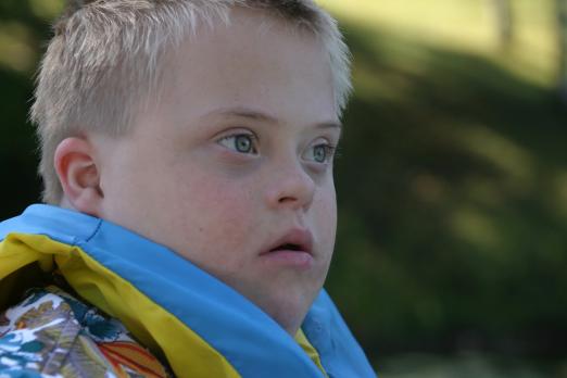 Optimale medische begeleiding van kinderen met downsyndroom