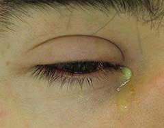 Aanvullende soa-zorg in Nederland