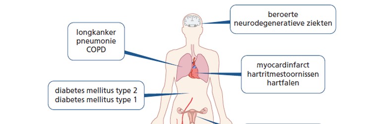 Fijnstof: onzichtbaar met onverwachte cardiovasculaire schade 