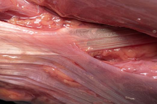 Kijk op fascia vanuit functioneel perspectief (BD)