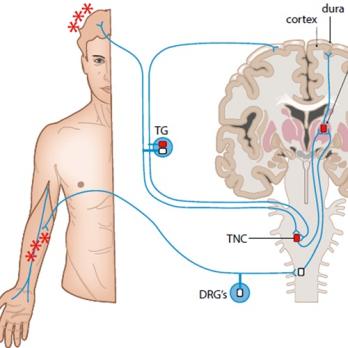 Medicatie overgebruikshoofdpijn (AF, BD)