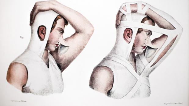 Een kleine geschiedenis van de bindweefselfysiologie