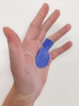 Triggerfinger: conservatief of operatief behandelen? (VI)