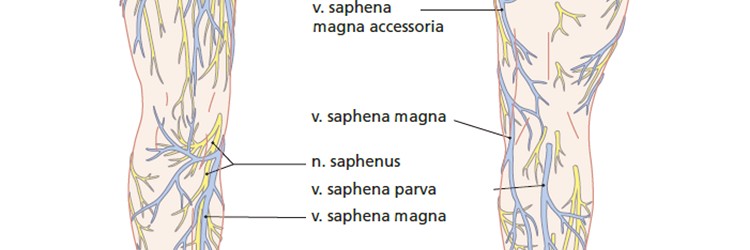 Varices: geen spat veranderd? 