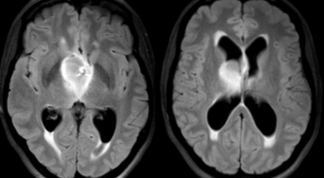 MRI van de hersenen bij de acute, intern ontregelde patiënt 